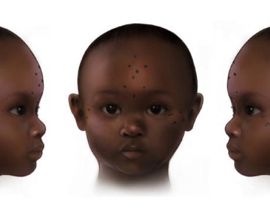 Reconstruction of tattooing on the forehead of a 3-year-old female (657–855 AD) from ancient Nubia.